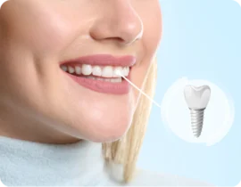 Implant unitaire
